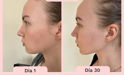 Masajeador Facial Antienvejecimiento con Microcorriente